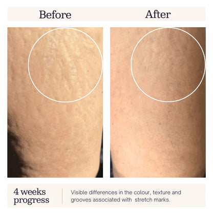 B Phyto Stretch Mark Oil